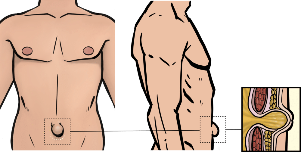 belly button inside diagram