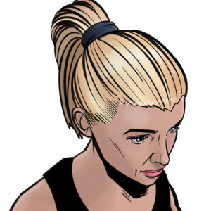 After: Between 1 and 3 cm of skin can usually be removed in a forehead reduction